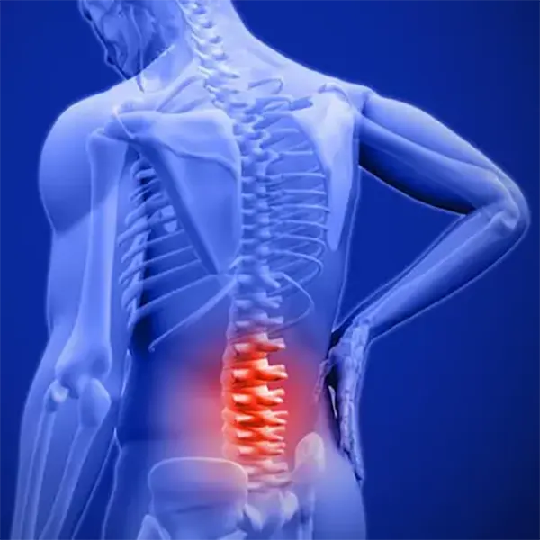 Spinal Decompression Treatment Near Me in Fayetteville, NC. Chiropractor For Non-Surgical Spinal Decompression.